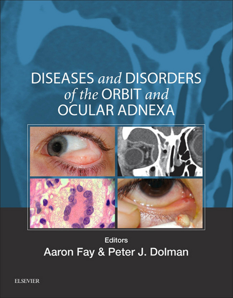 Diseases and Disorders of the Orbit and Ocular Adnexa -  Aaron Fay,  Peter J Dolman