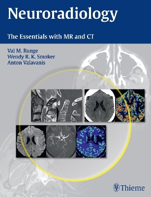 Neuroradiology - Val M. Runge, Antonios Valavanis