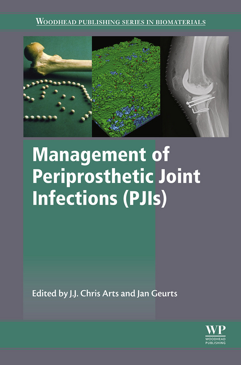 Management of Periprosthetic Joint Infections (PJIs) - 