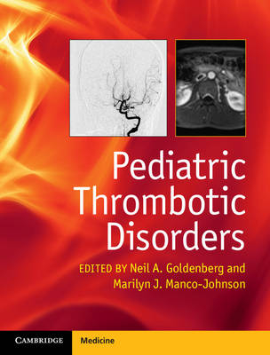 Pediatric Thrombotic Disorders - 