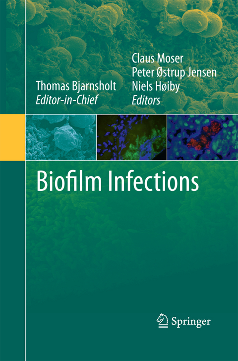 Biofilm Infections - 