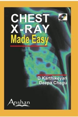 Chest X-Ray Made Easy - D Karthikeyan