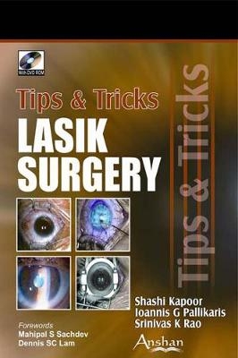 Lasik Surgery Tips and Tricks - 