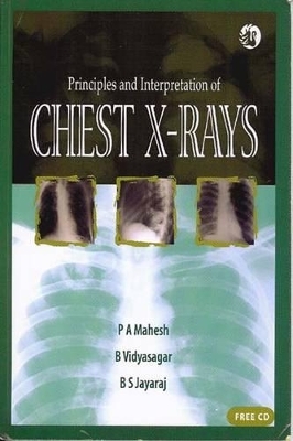 Principles and Interpretation of Chest X-rays - P A Mahesh, B Vidyasgar, B S Jayaraj