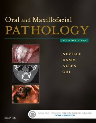 Oral and Maxillofacial Pathology - Brad W. Neville, Douglas D. Damm, Carl M. Allen, Angela C. Chi