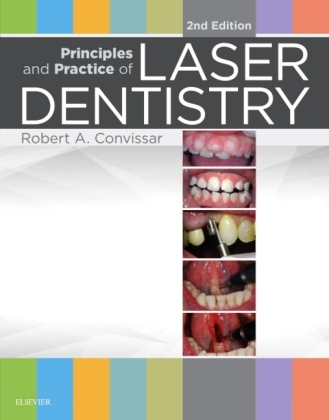 Principles and Practice of Laser Dentistry - Robert A. Convissar