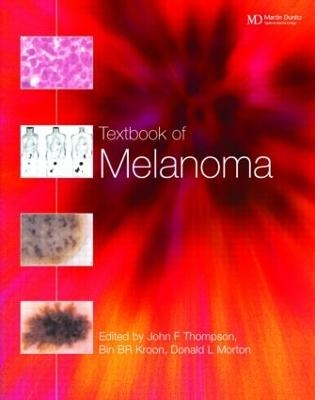 Textbook of Melanoma - 