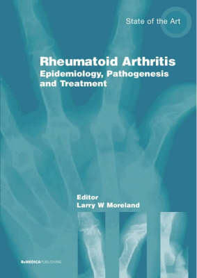 Management Rheumatoid Arthriti - Hazel Aston, Gary Firestein, Sherine Gabriel, Mark Genovese, Arthur Kavanaugh