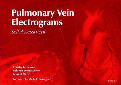 Pulmonary Vein Electrograms - Christophe Scavee, Rukshen Weerasooriya, Laurent Macle