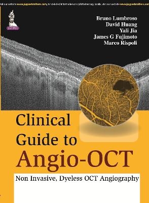 Clinical Guide to Angio-OCT: Non Invasive, Dyeless OCT Angiography - Bruno Lumbroso, David Huang, Yali Jia, James G Fujimoto, Marco Rispoli