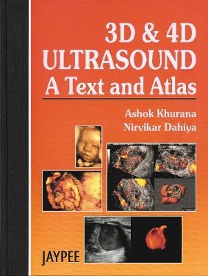 3D and 4D Ultrasound: A Text and Atlas - Dr Ashok Khurana, Nirvikar Dahiya