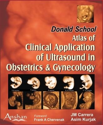 Atlas of Clinical Application of Ultrasound in Obsterics and Gynaecology - J M Carrera, Asim Kurjak