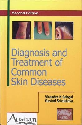 Diagnosis and Treatment of Common Skin Diseases - Virendra Sehgal, Govind Srivastava