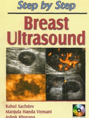 Step by Step:Breast Ultrasound - Rahul Sachdev, Manjula Handa Virmani, Ashok Khurana