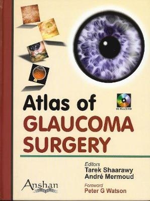 Atlas of Glaucoma Surgery - Tarek Shaarawy, Andre Mermoud