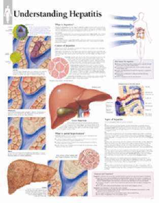 Understanding Hepatitis Laminated Poster -  Scientific Publishing