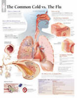 Common Cold vs the Flu Laminated Poster -  Scientific Publishing