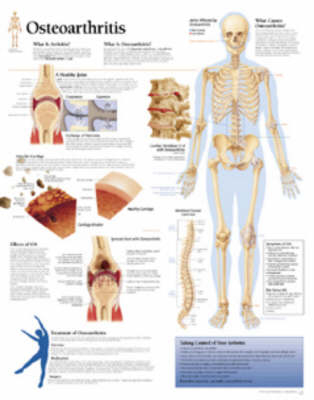 Osteoarthritis Paper Poster -  Scientific Publishing