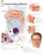 Understanding Rhinitis Paper Poster -  Scientific Publishing