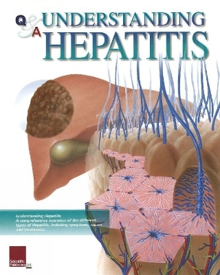 Understanding Hepatitis Flip Chart -  Scientific Publishing