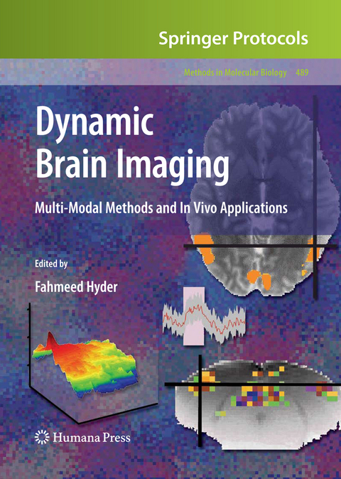 Dynamic Brain Imaging - 