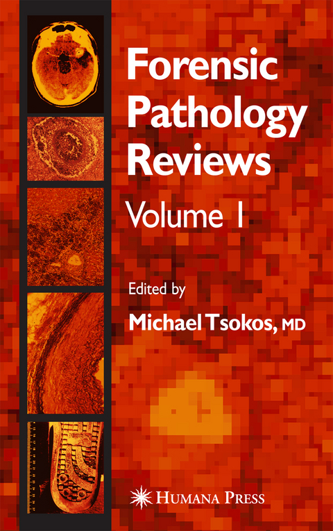 Forensic Pathology Reviews - Michael Tsokos