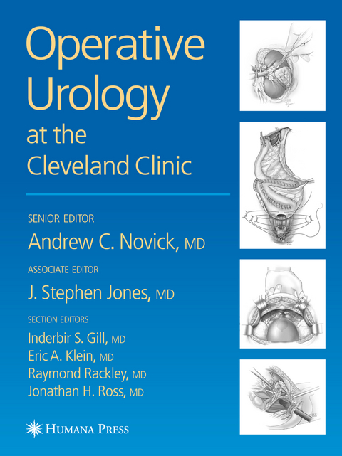 Operative Urology - 