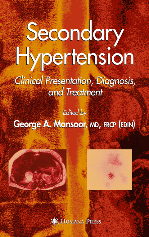 Secondary Hypertension - 