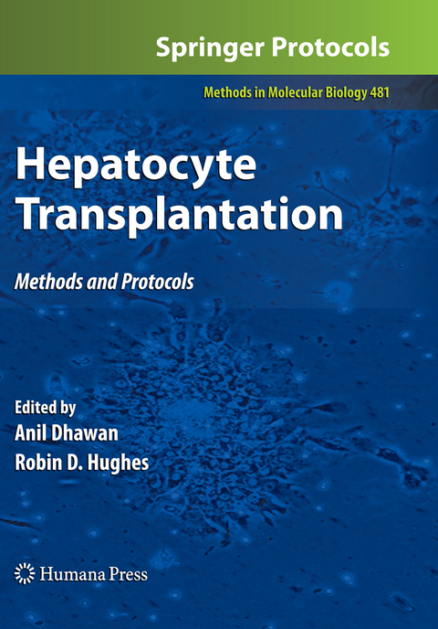 Hepatocyte Transplantation - 