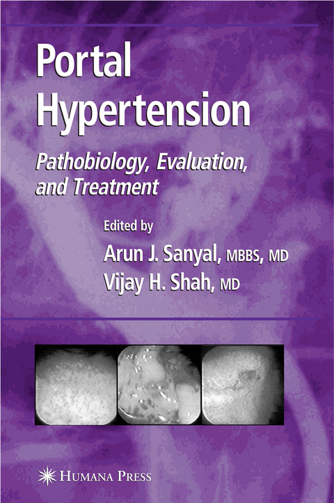 Portal Hypertension - 