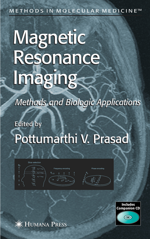 Magnetic Resonance Imaging - 