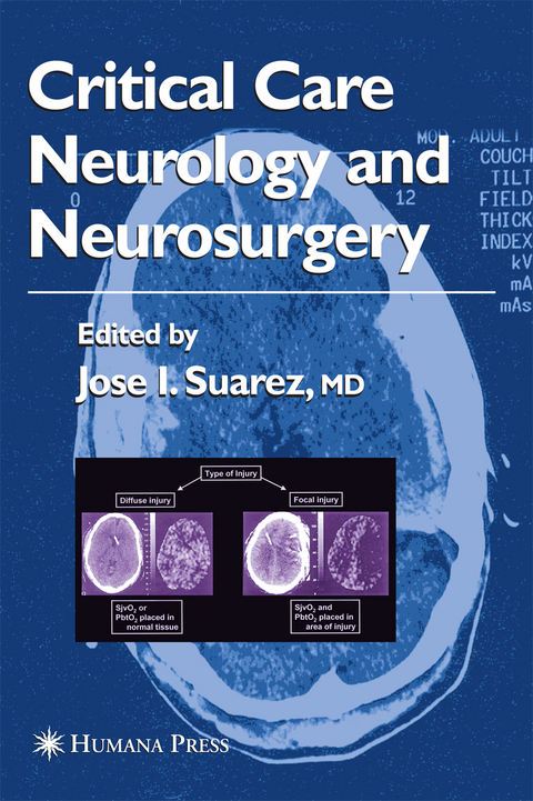 Critical Care Neurology and Neurosurgery - 