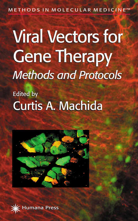 Viral Vectors for Gene Therapy - 