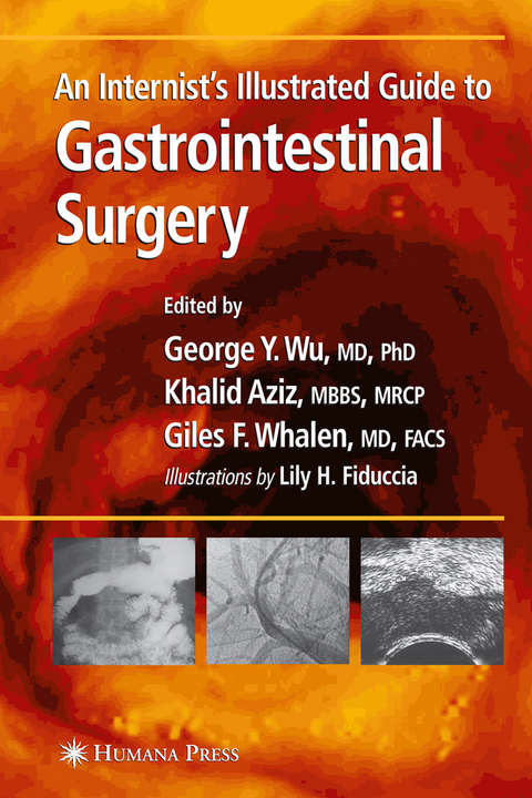 An Internist’s Illustrated Guide to Gastrointestinal Surgery - 