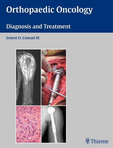 Orthopaedic Oncology - 