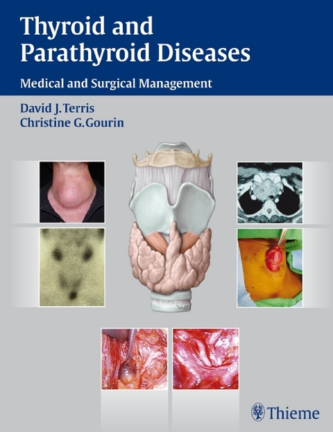 Thyroid and Parathyroid Diseases - 