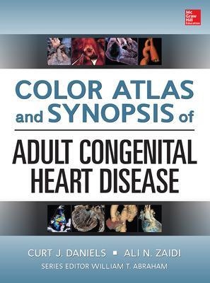 Color Atlas and Synopsis of Adult Congenital Heart Disease - Curt Daniels, Ali Zaidi