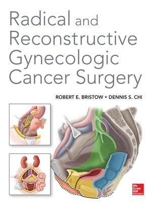 Radical and Reconstructive Gynecologic Cancer Surgery - Robert Bristow, Dennis Chi