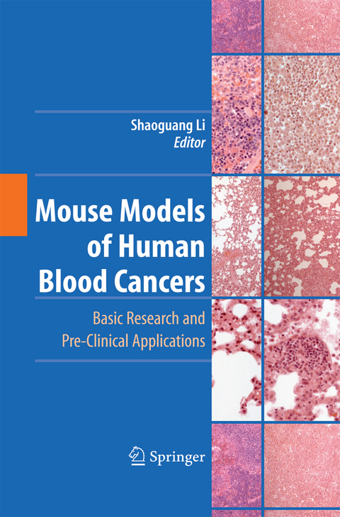 Mouse Models of Human Blood Cancers - 