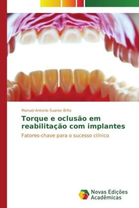 Torque e oclusão em reabilitação com implantes - Manuel Antonio Suárez Brito