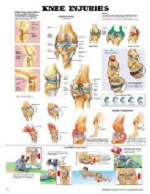 Knee Injuries -  Anatomical Chart Company