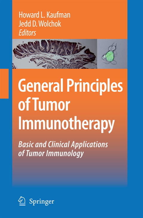 General Principles of Tumor Immunotherapy - 