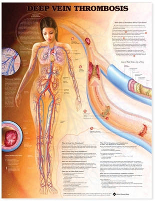 Deep Vein Thrombosis Anatomical Chart