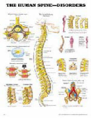 The Human Spine Disorders -  Anatomical Chart Company