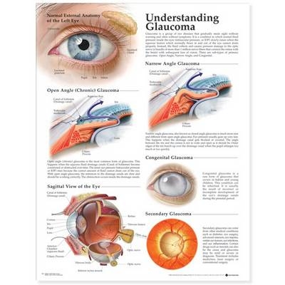 Understanding Glaucoma Anatomical Chart