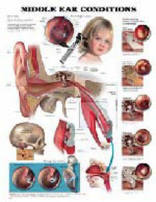 Middle Ear Conditions -  Anatomical Chart Company