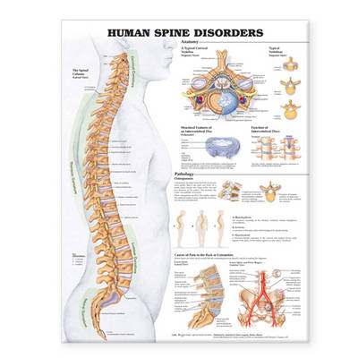 Human Spine Disorders Anatomical Chart