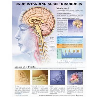 Understanding Sleep Disorders Anatomical Chart