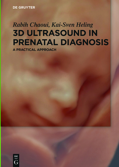 3D Ultrasound in Prenatal Diagnosis -  Rabih Chaoui,  Kai-Sven Heling