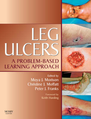 Leg Ulcers E-Book -  Peter Franks,  Christine Moffatt,  Moya Morison